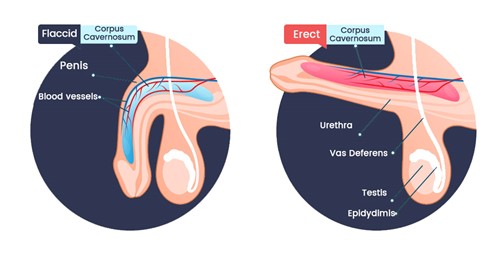 Erectile dysfunction