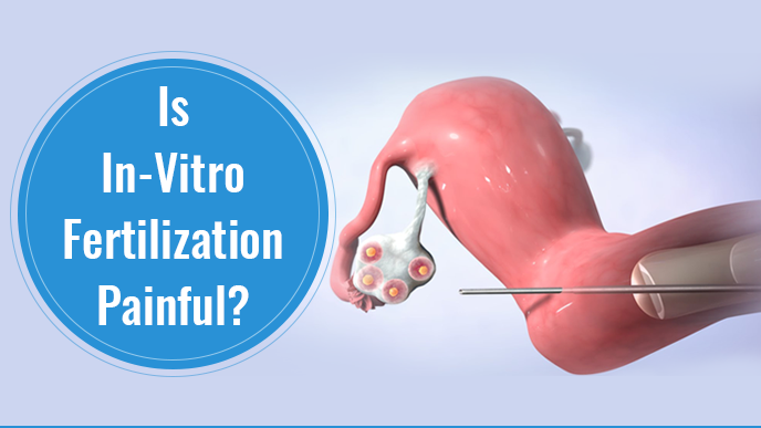 In Vitro Fertilization