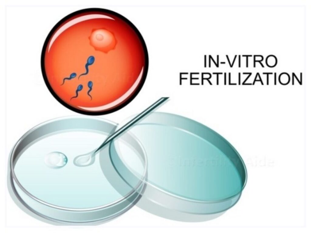 art of in vitro fertilization