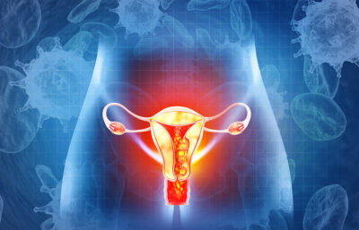 Endometrial Thickness