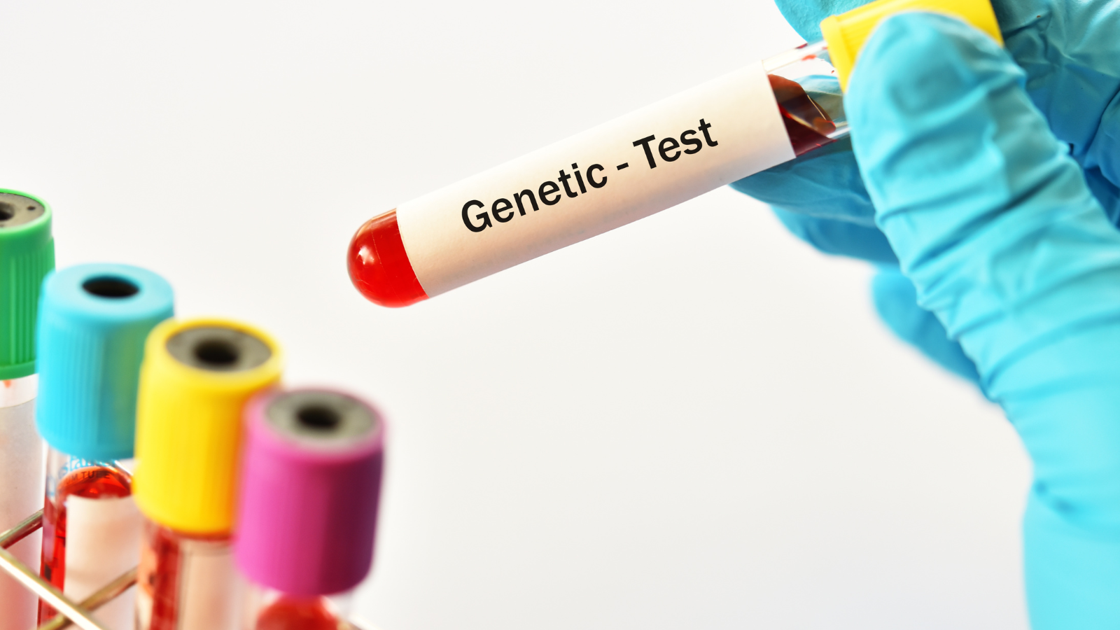 Genetic Testing