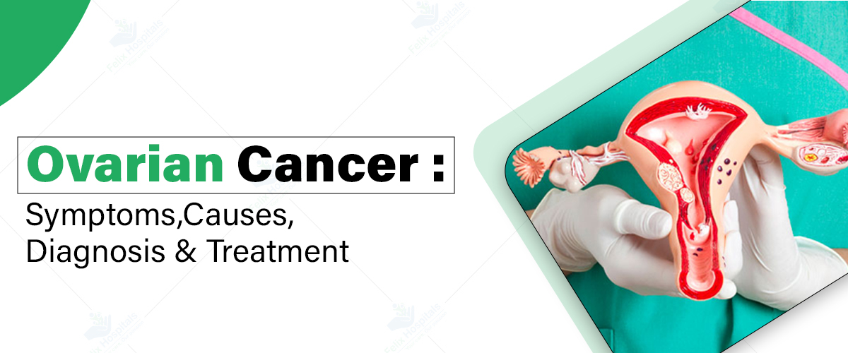 Ovarian Cancer Treatment